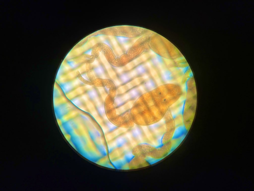 Iodine stained avian cercariae as seen down a light microscope