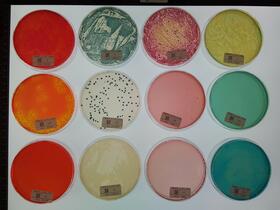 Bacteria grown on different nutrient agar plates 