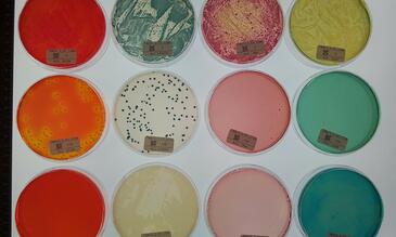 Bacteria grown on different nutrient agar plates 