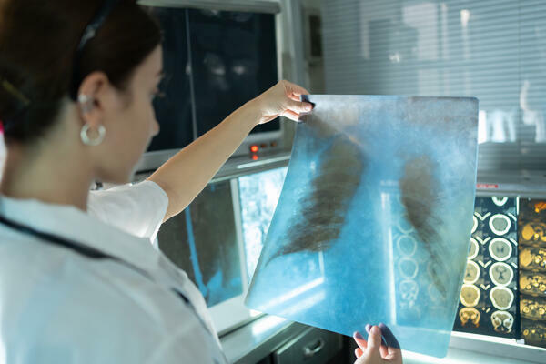 Woman radiology doctor examining chest x-ray film of patient in health care