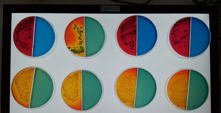 New research aims to prevent transmission of enteric bacteria and tackle  antimicrobial resistance