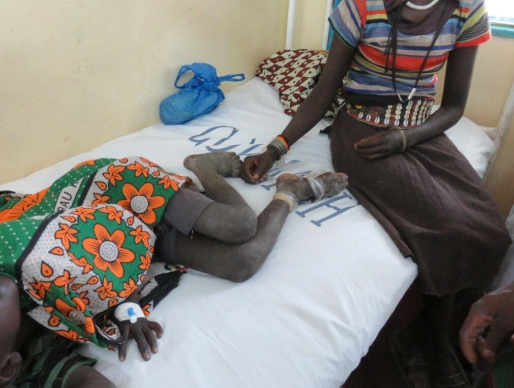 It took this mother 14 hours to get her child, who was bitten by a snake, to hospital in Baringo, Kenya to receive antivenom. The amount of time required for a snakebite victim to reach a medical centre to receive treatment remains a major issue in rural African communities. Photo taken by Prof. Rob Harrison. It took this mother 14 hours to get her child, who was bitten by a snake, to hospital in Baringo, Kenya to receive antivenom. The amount of time required for a snakebite victim to reach a medical centre to receive treatment remains a major issue in rural African communities. Photo taken by Prof. Rob Harrison.