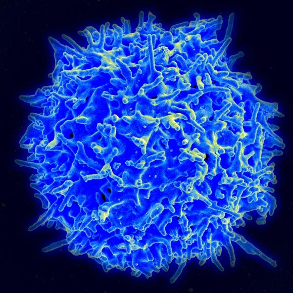 Healthy Human T Cell.jpg Healthy Human T Cell.jpg