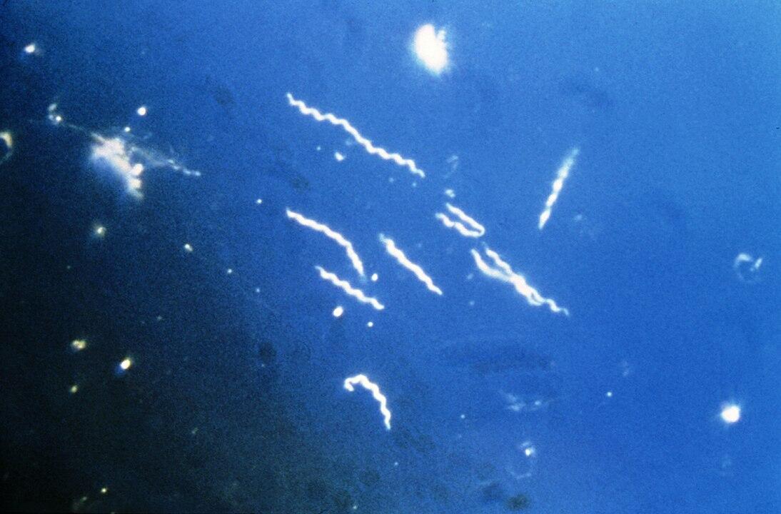 Borrelia burgdorferi - credit: CDC Borrelia burgdorferi - credit: CDC