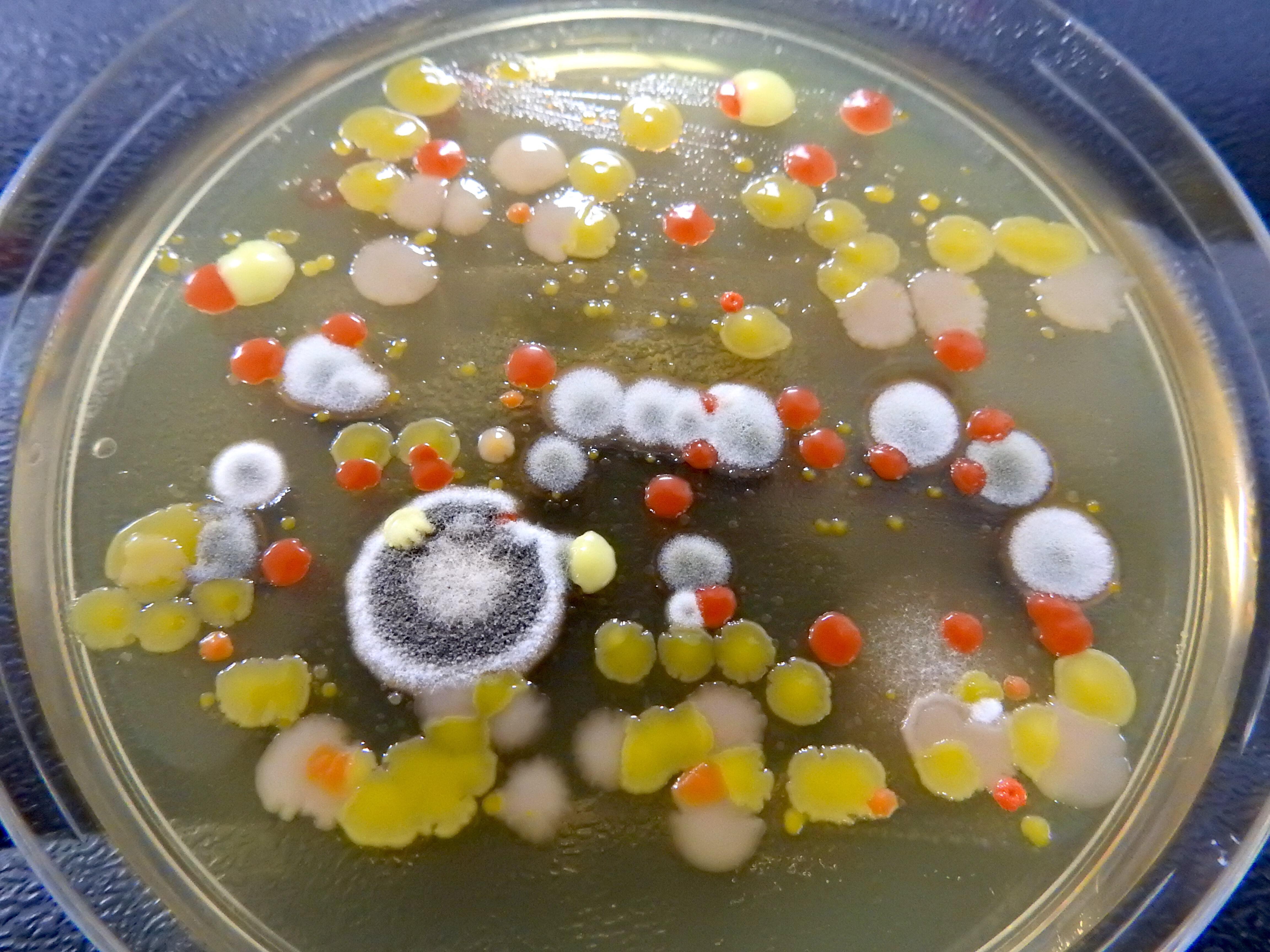 A variety of different bacteria and fungi isolated as part of LSTM's Swab and Send project A variety of different bacteria and fungi isolated as part of LSTM's Swab and Send project