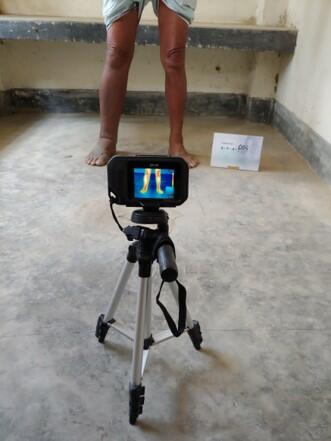 Camera set up for taking images of participants lower legs Camera set up for taking images of participants lower legs