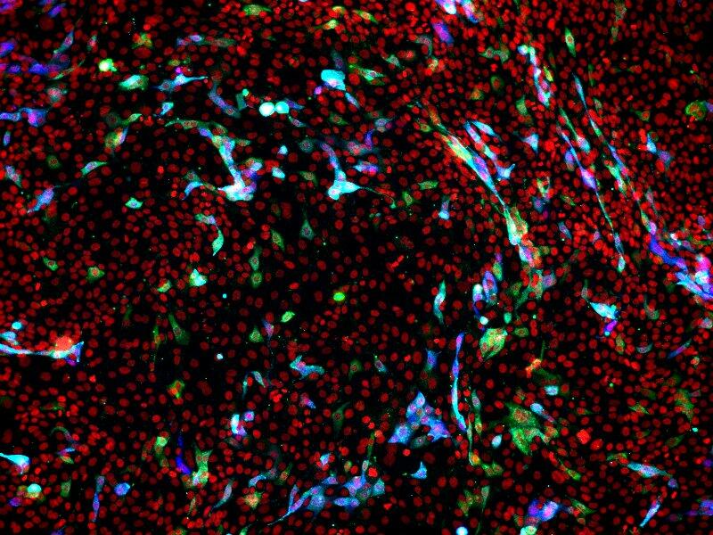 Infected lung epithelial cells Infected lung epithelial cells