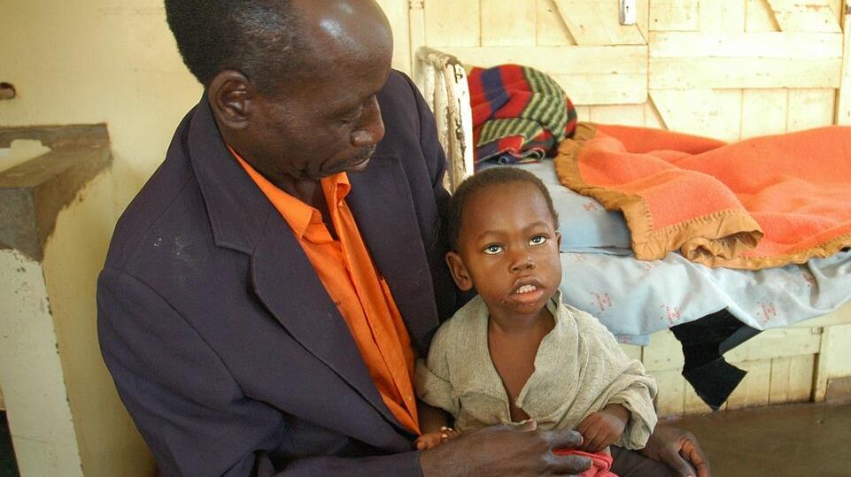Credit: Jmesser5 via Wikimedia Commons. Child recovering from cerebral malaria Credit: Jmesser5 via Wikimedia Commons. Child recovering from cerebral malaria