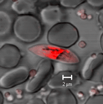 Plasmodium falciparum late-stage gametocyte, one of the parasite stages targeted by primaquine Plasmodium falciparum late-stage gametocyte, one of the parasite stages targeted by primaquine