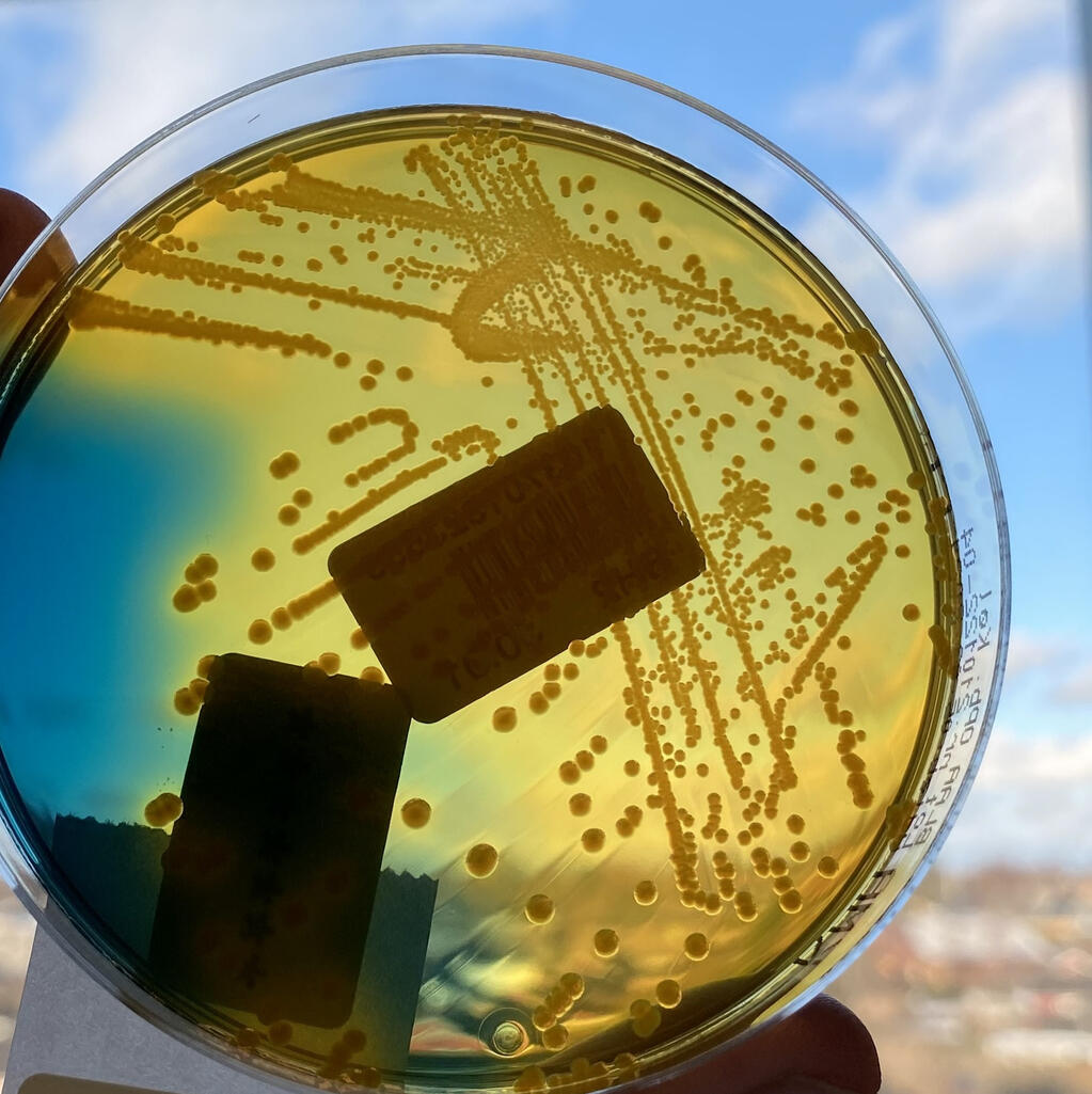 E.coli grown on an agar plate held against the sky E.coli grown on an agar plate held against the sky