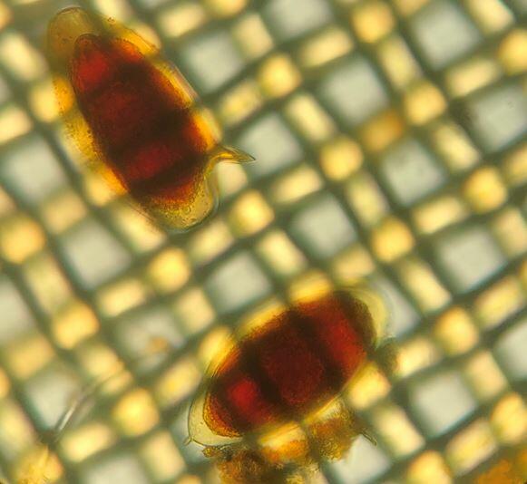 image of eggs of Schistosoma haematobium and S. mansoni in the urine of a Malawian male child. Image: Dr Seke Kayuni image of eggs of Schistosoma haematobium and S. mansoni in the urine of a Malawian male child. Image: Dr Seke Kayuni