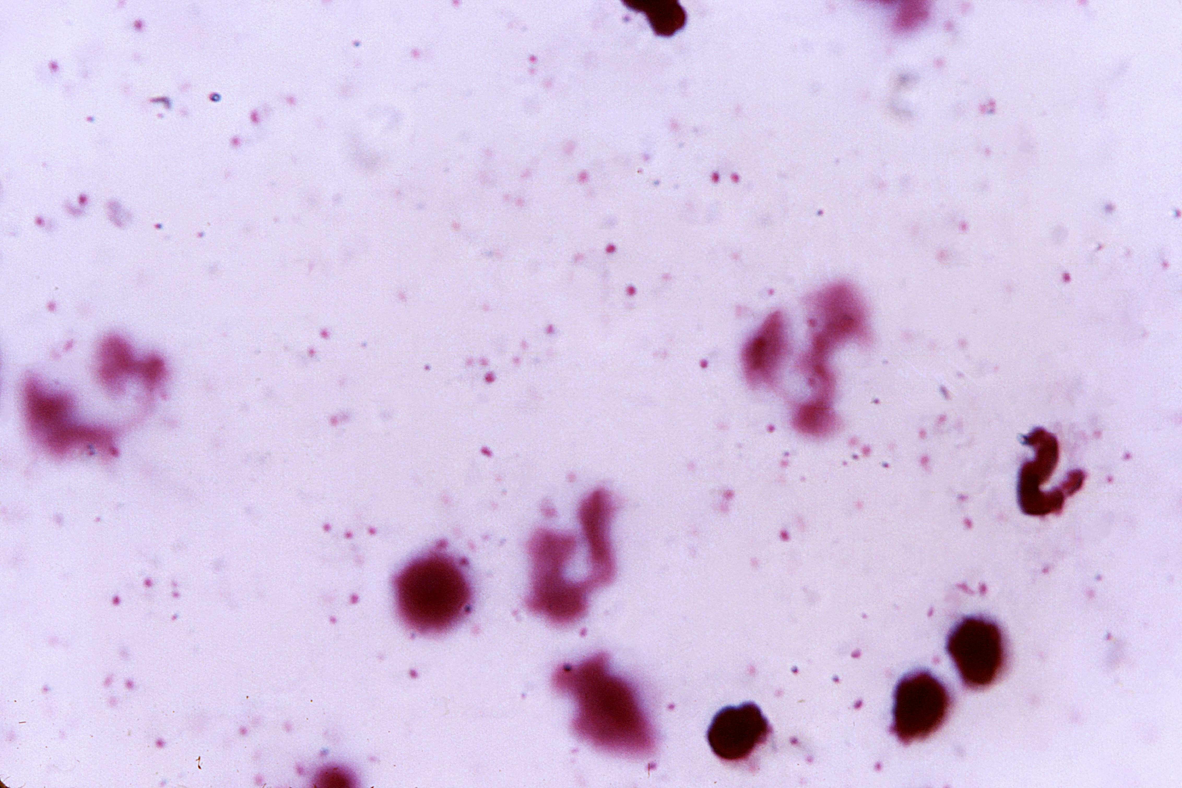 plasmodium falciparum plasmodium falciparum