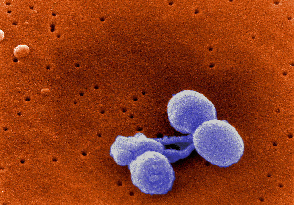 Scanning Electron Micrograph of Streptococcus pneumoniae. 