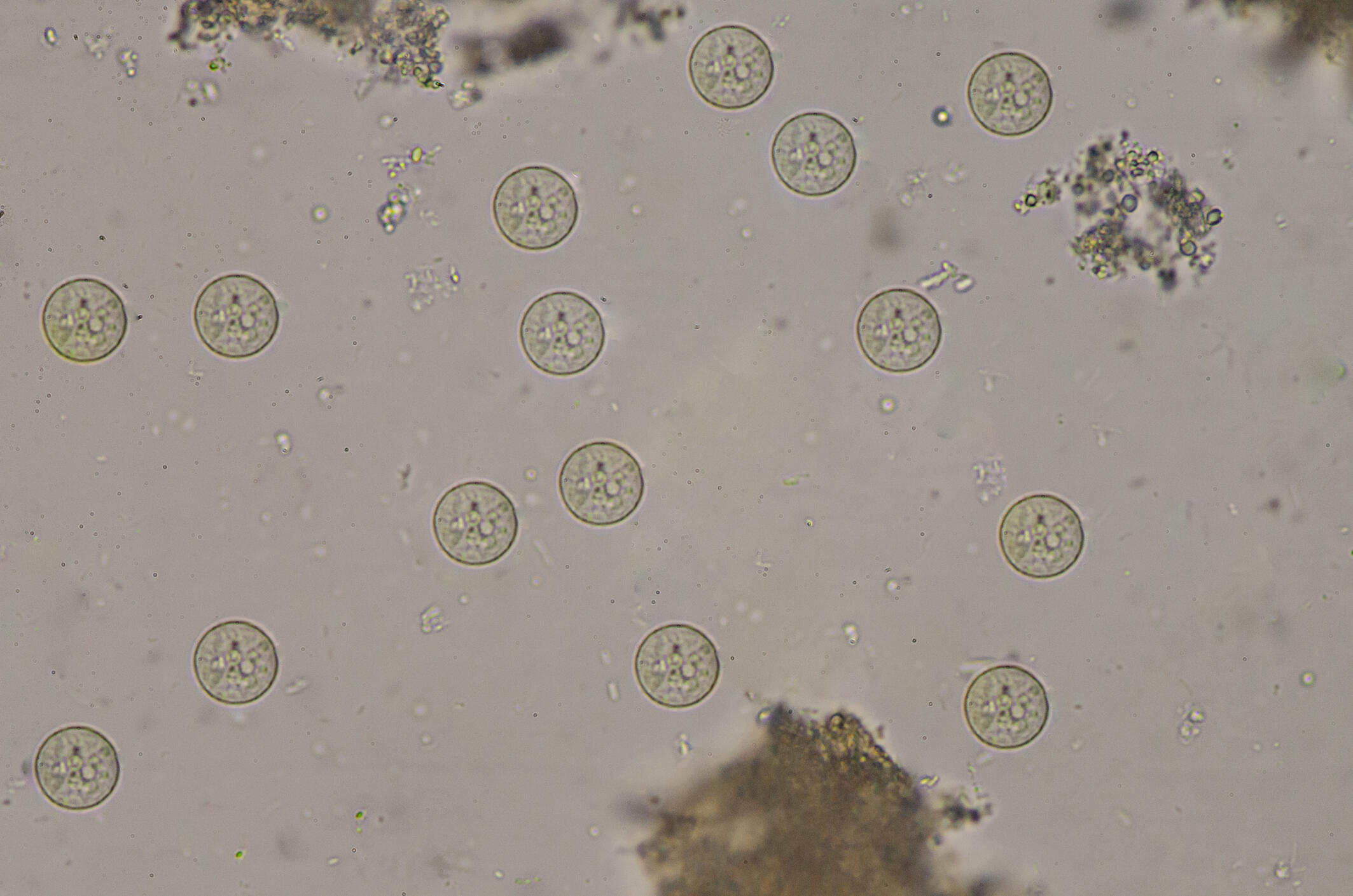 Parasite Serology Amoebiasis Entamoeba Histolytica Lstm 4281