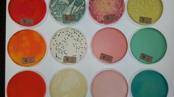 Bacteria grown on different nutrient agar plates 